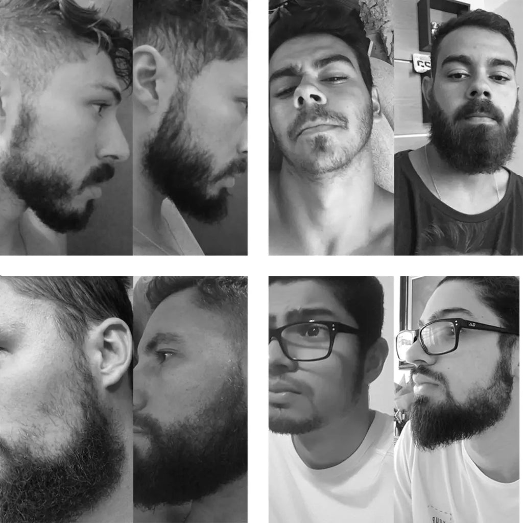 🔥 ACABE COM AS FALHAS DA BARBA!  💥 BARBA MAIS CHEIA E VOLUMOSA EM POUCAS SEMANAS
