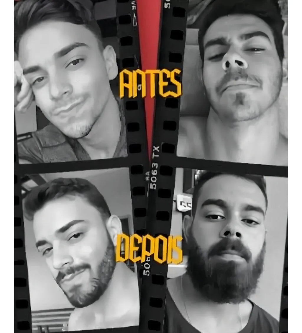 🔥 ACABE COM AS FALHAS DA BARBA!  💥 BARBA MAIS CHEIA E VOLUMOSA EM POUCAS SEMANAS